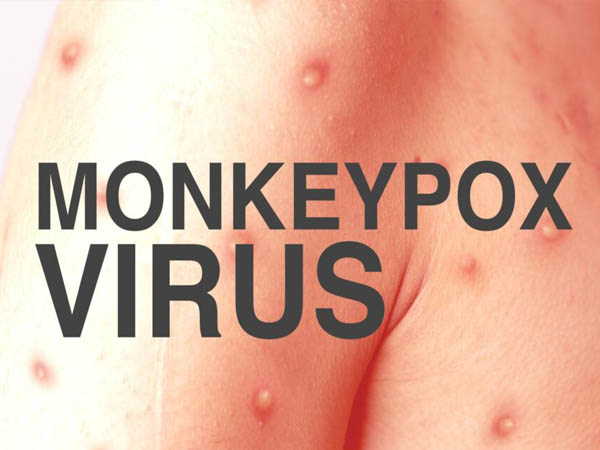 Monkeypox Virus – Parcours de soins spécifique – Hôpital de Pontoise